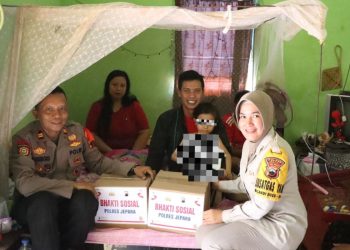 Peduli kepada Warganya, Polres Jepara Beri Bantuan ke Bocah Terkena Luka Bakar